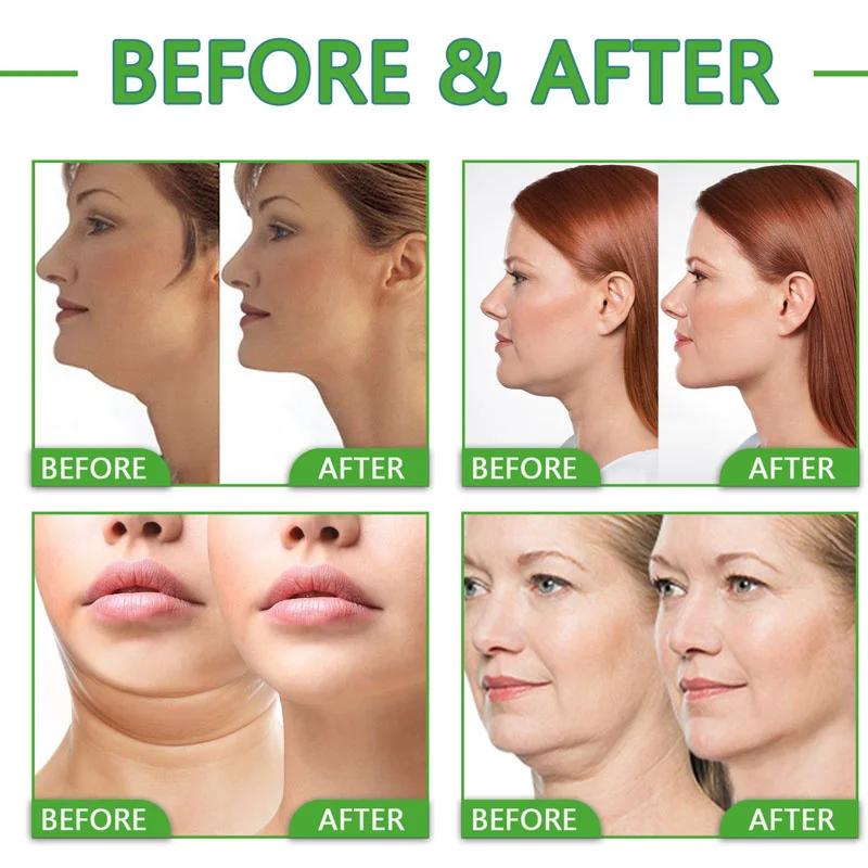 kf-Sce760e26aed24666a6bcc799021f1dad0-Collagen-Wrinkle-Removal-Neck-Cream-Anti-aging-Firm-Niacinamide-Whitening-Skin-Care-Hyaluronic-Acid-Moisturizing-Repair